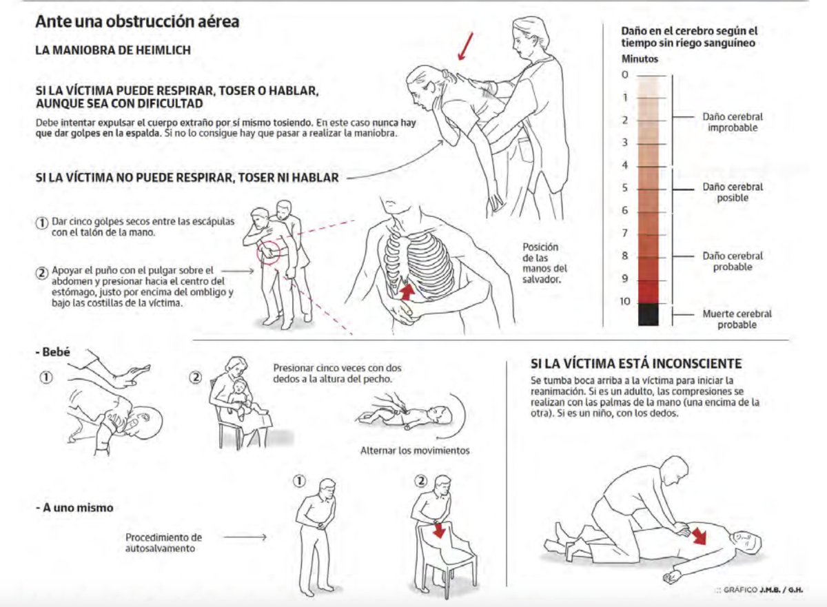 EnfermeroEnred's tweet photo. 🚨 Urgencia Pediátrica: La obstrucción de la vía aérea por cuerpo extraño (#OVACE) es común en niños. Actuar rápido es vital para evitar riesgos graves como la parada cardiorrespiratoria.
Aprende las maniobras de desobstrucción y salva vidas.
https://t.co/ylAyrBTA5Q https://t.co/Oru4JSyZvL