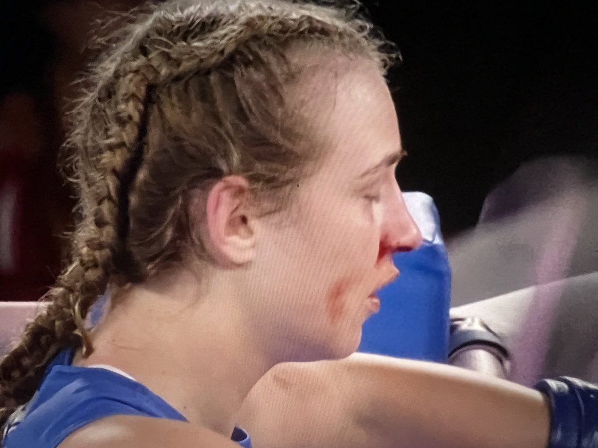 HazelAppleyard's tweet photo. Look at her. Just look at her. 

Bleeding at the fists of a man. 

The #Olympics glorifies male v!olence against women. 

Save women’s sports. https://t.co/xUr0hnESLB
