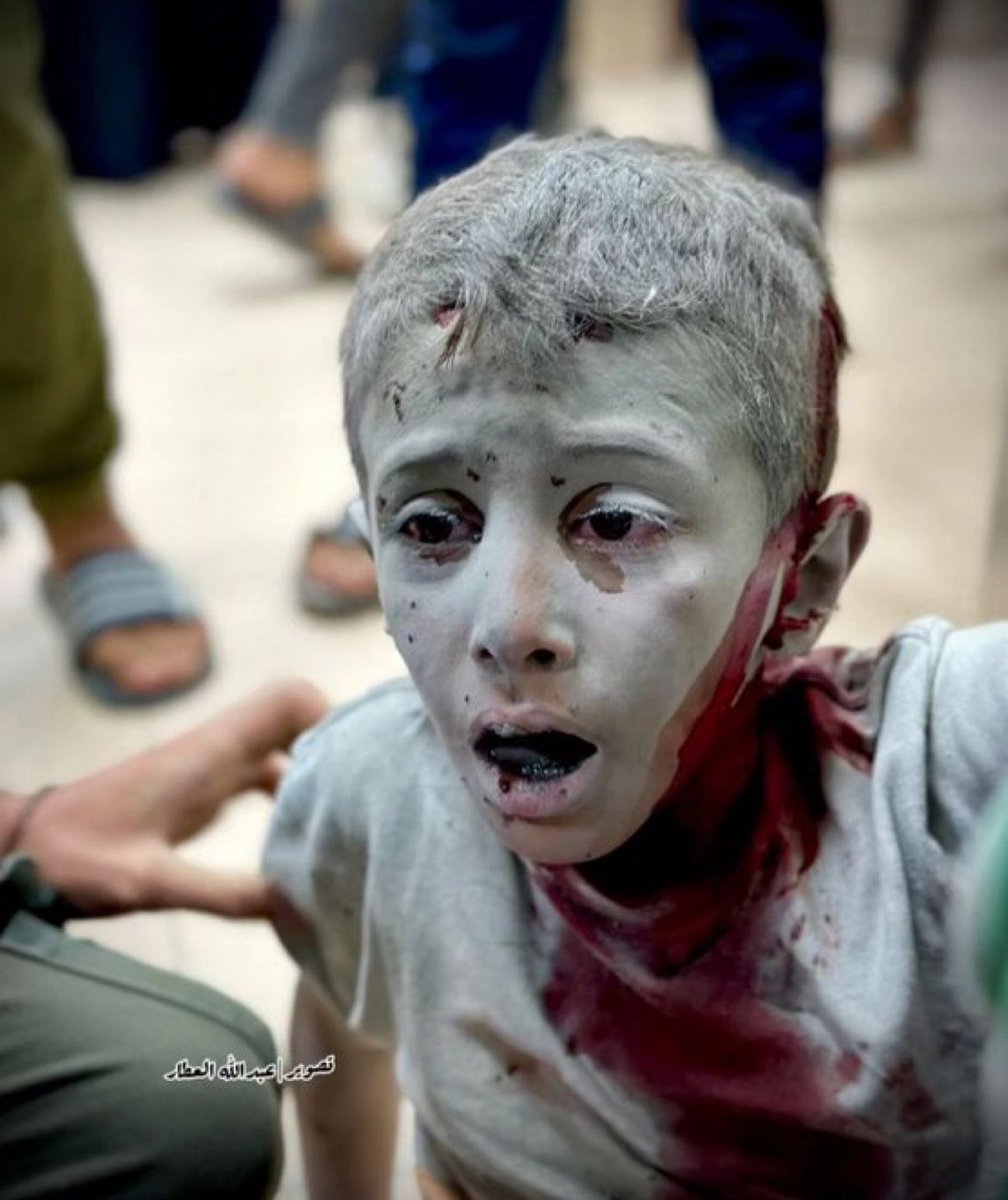 selinaytcc's tweet photo. Susmayın ,alışmayın, alıştırmayın!!!!!
Katil #Israel 
#GazzeKanGölü 
#GazzeKanayanYaramız
#GazzedekiSoykırımaDurDe https://t.co/Kh99OPPOIU