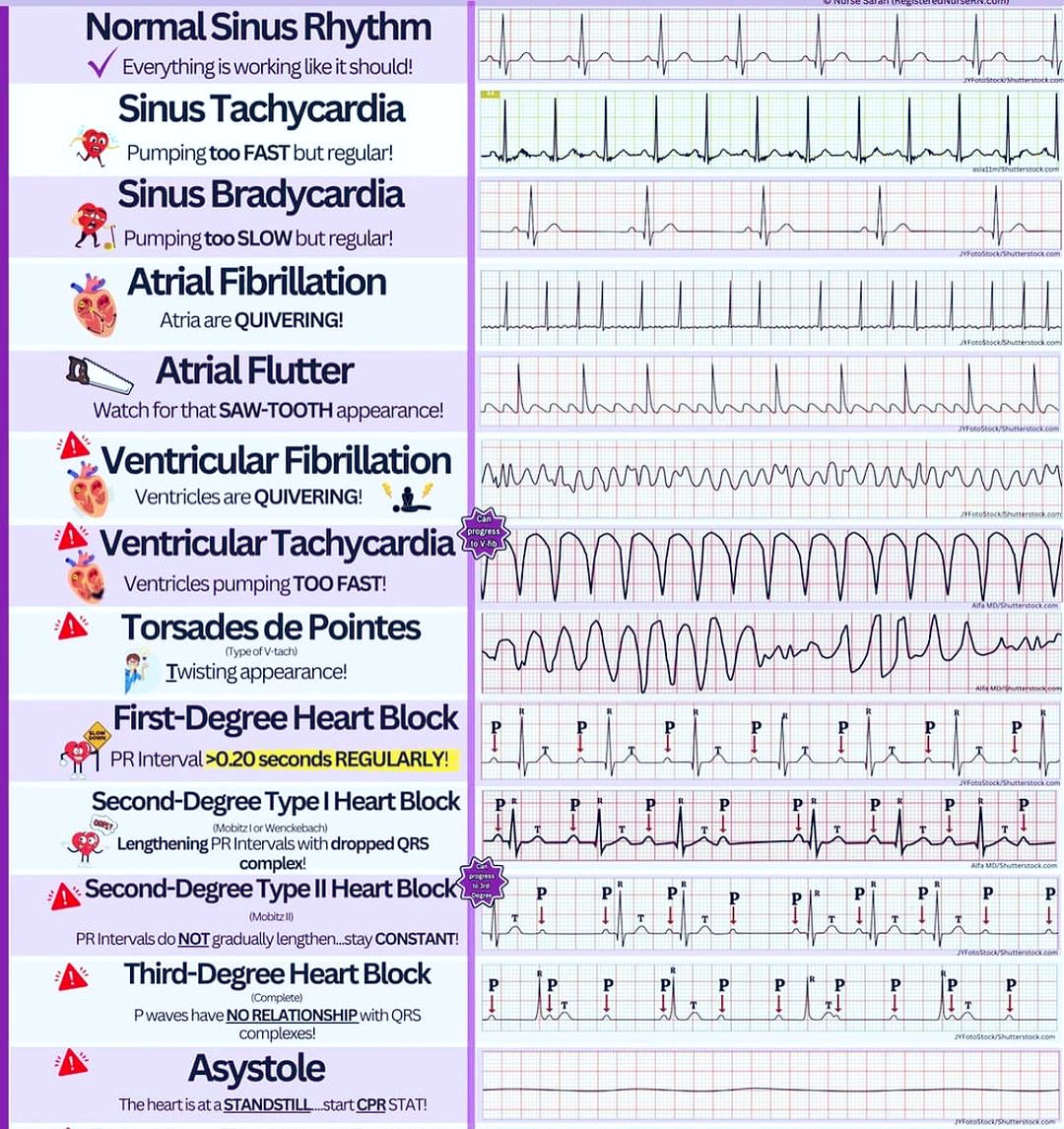 Doctors__squad's tweet photo. Heart Rhythm | Health Sector 📌 https://t.co/uHmw9UI1Vm