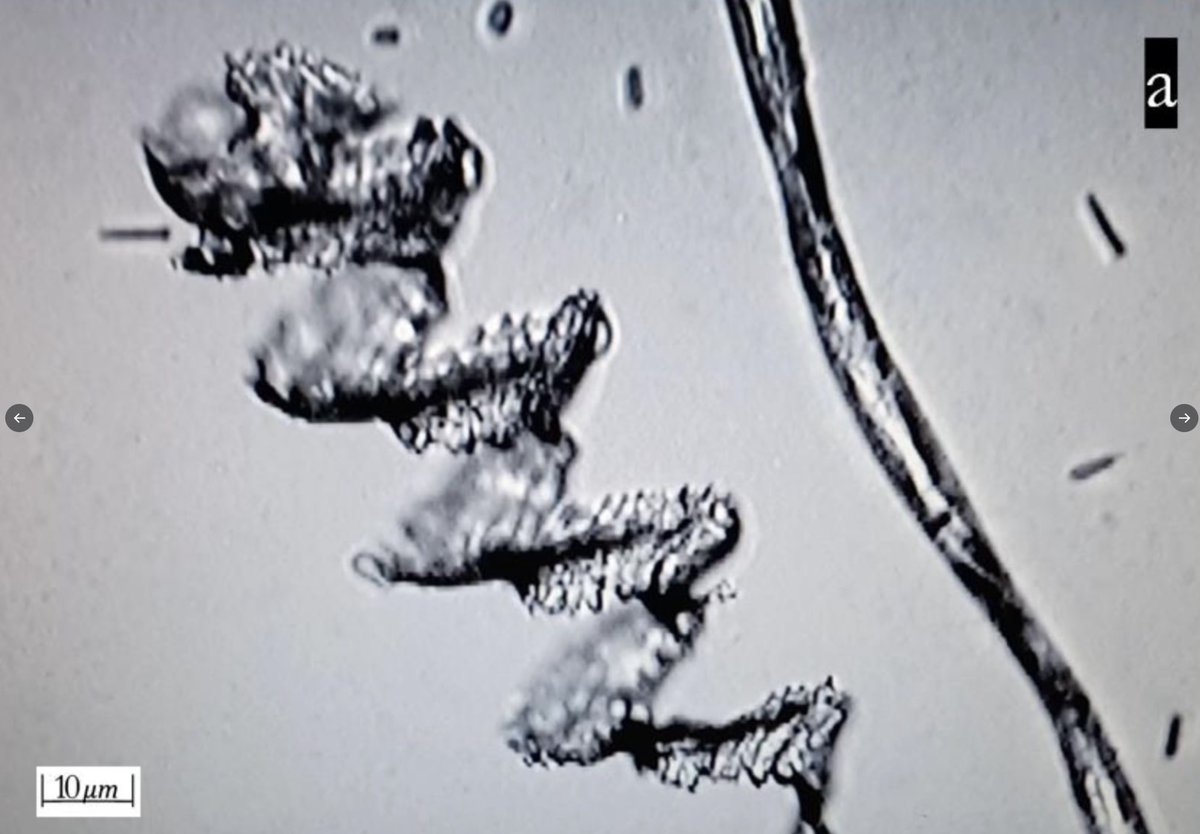 RealWsiegrist's tweet photo. Artefakte oder relevante Strukturen?
Echtzeit-Selbstorganisation von stereomikroskopisch sichtbaren künstlichen Konstruktionen in bebrüteten Proben von mRNA-Produkten, hauptsächlich von Pfizer und Moderna: Eine umfassende Längsschnittstudie.
Eine neue japanische Studie beweist, dass Pfizer- und Moderna-Präparate unautorisierte, für das menschliche Auge unsichtbare "animierte wurmartige" Gebilde enthalten, die schwimmen, wackeln und sich zu komplexen Strukturen zusammenfügen, die im Körper Gerinnsel verursachen. (Was der Einbalsamierer Richard Hirschman in dem Film Died Suddenly gefunden und enthüllt hat).
Dr. Young Mi Lee und Dr. Daniel Broudy von der Okinawa Christian University entdeckten diese "ungenannten zusätzlichen künstlichen Komponenten", indem sie unbenutzte Vaxx-Fläschchen drei Wochen lang isolierten und sie dann unter 400-facher Vergrößerung untersuchten.
Lee und Broudy sahen, dass die Nanotechnologie, wenn sie unter Strom gesetzt wurde, "Scheiben, Ketten, Spiralen, Röhren und rechtwinklige Strukturen" bildete.
Die Forscher, die ihre Ergebnisse im International Journal of Vaccine Theory Practice and Research veröffentlichten, glauben, dass diese mysteriösen Nanopartikel für die explosionsartige Zunahme von "Turbokrebs" und Autoimmunkrankheiten rund um den Globus verantwortlich sind.
https://t.co/WCXZtZs1g1
Real-Time Self-Assembly of Stereomicroscopically Visible Artificial Constructions in Incubated Specimens of mRNA Products Mainly from Pfizer and Moderna: A Comprehensive Longitudinal Study. (2024). International Journal of Vaccine Theory, Practice, and Research , 3(2), 1180-1244. https://t.co/38rDRKSLYp