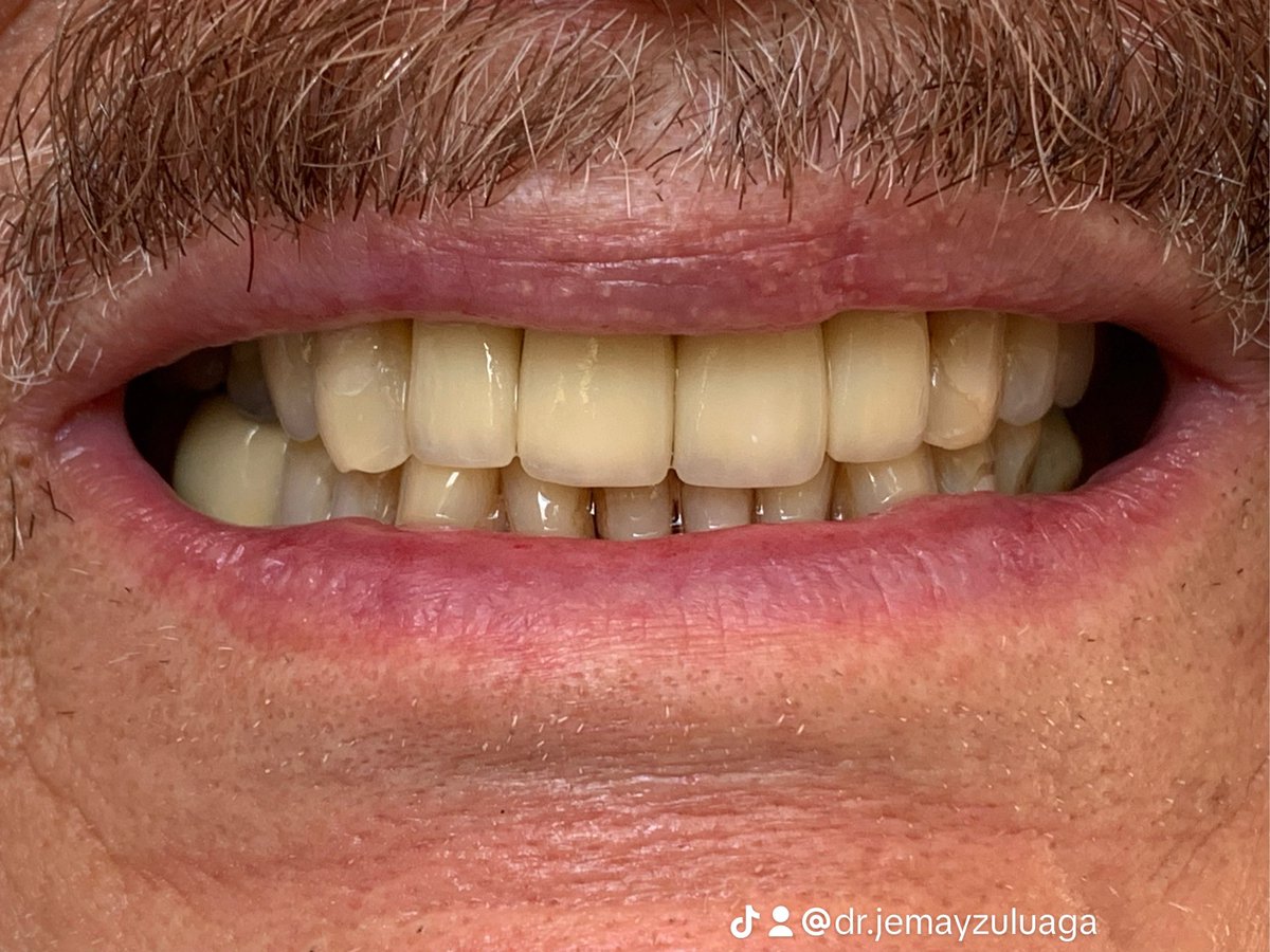 sonriaperfecto's tweet photo. https://t.co/ndRuYNSRIj