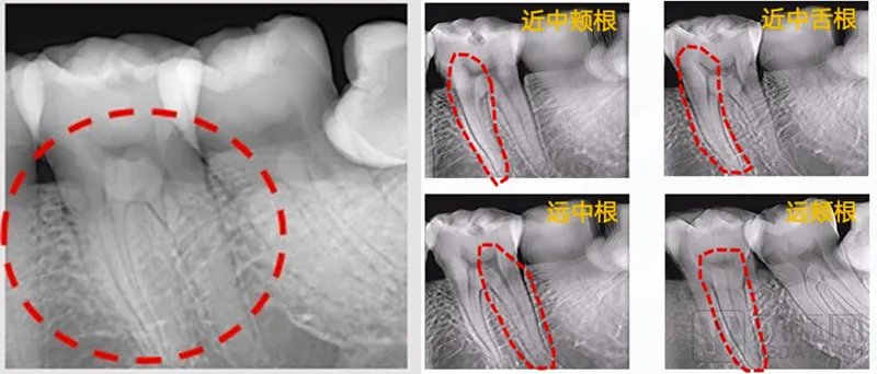 lewzitty's tweet photo. x ray equipments for teeth healthy https://t.co/eQA0JdgRcw