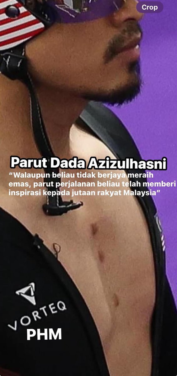 health_malaysia's tweet photo. Parut Dada Azizulhasni

Mungkin tiada kalungan emas di leher Azizul di Olimpik, tetapi ada sesuatu yang lebih mendalam dan abadi terpahat di dadanya—sebuah simbol keberanian yang akan menjadi saksi sepanjang hayatnya.

Thread. https://t.co/kKhcmJQOgu