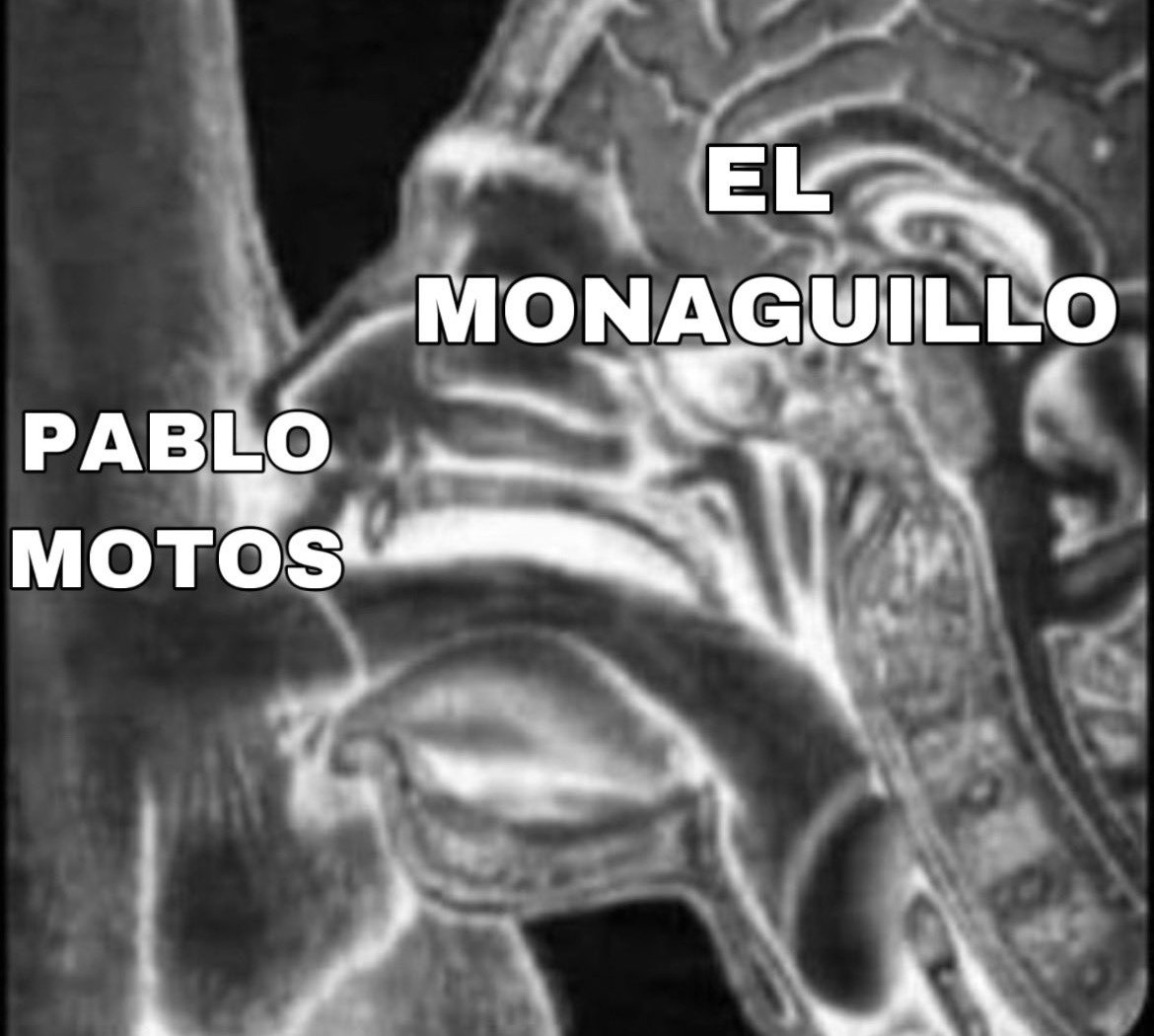 alvar_marquez's tweet photo. @h0m3r02 https://t.co/P7TsW5xIHA
