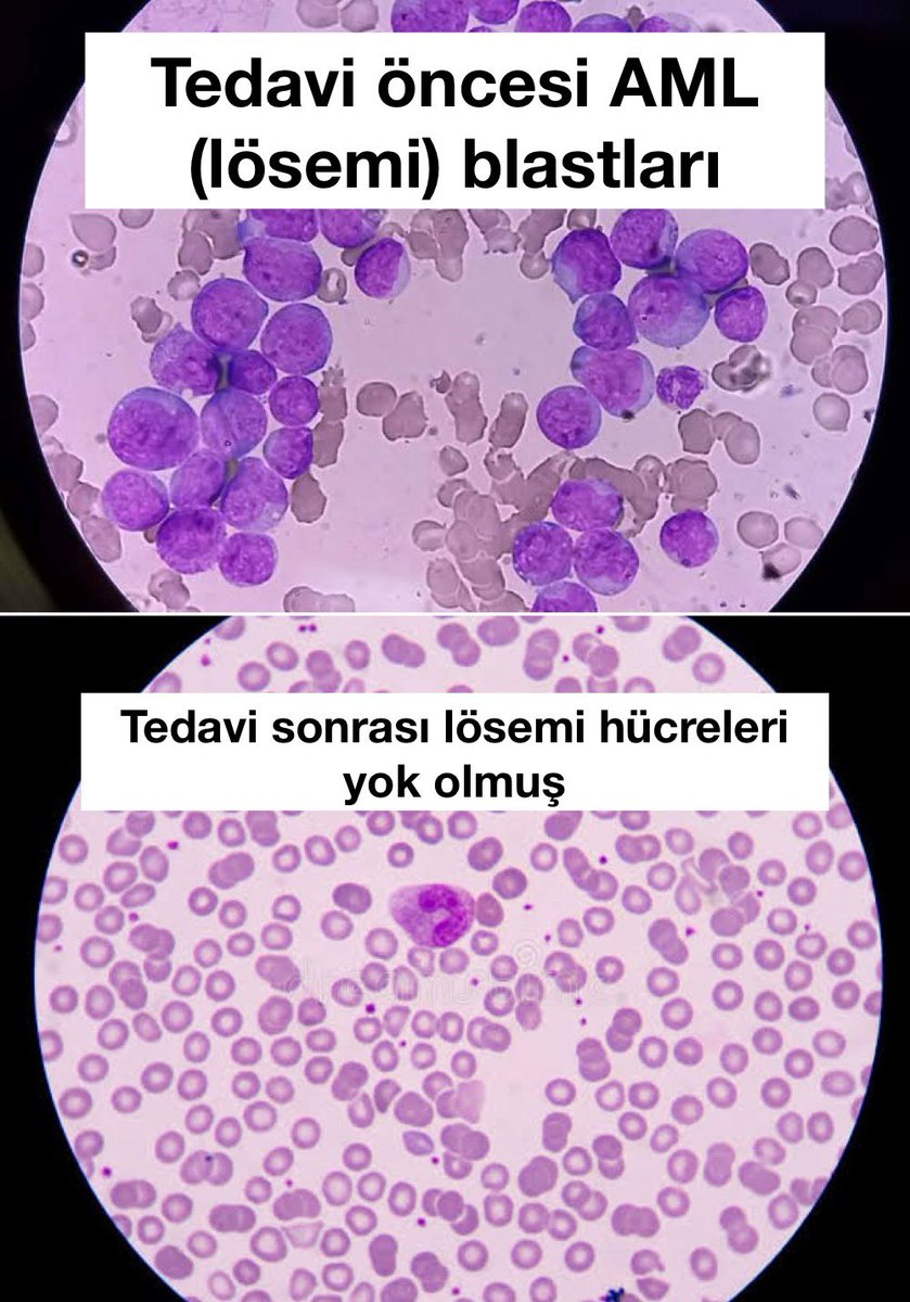ativittta's tweet image. Ben ve benim sanatım.