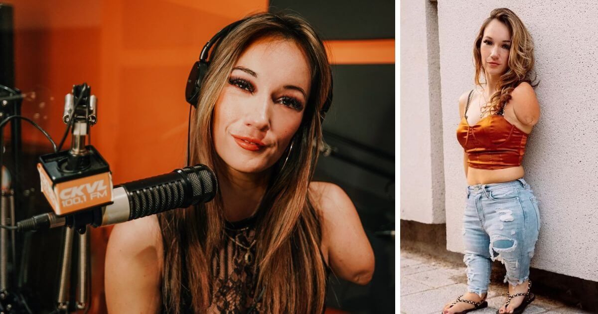 LifeNewsHQ's tweet photo. Woman Who Lost One Arm and Half Her Legs in Botched Abortion Now a Popular Radio Host https://t.co/CaiocEUHTf https://t.co/qCcOY63Bv0