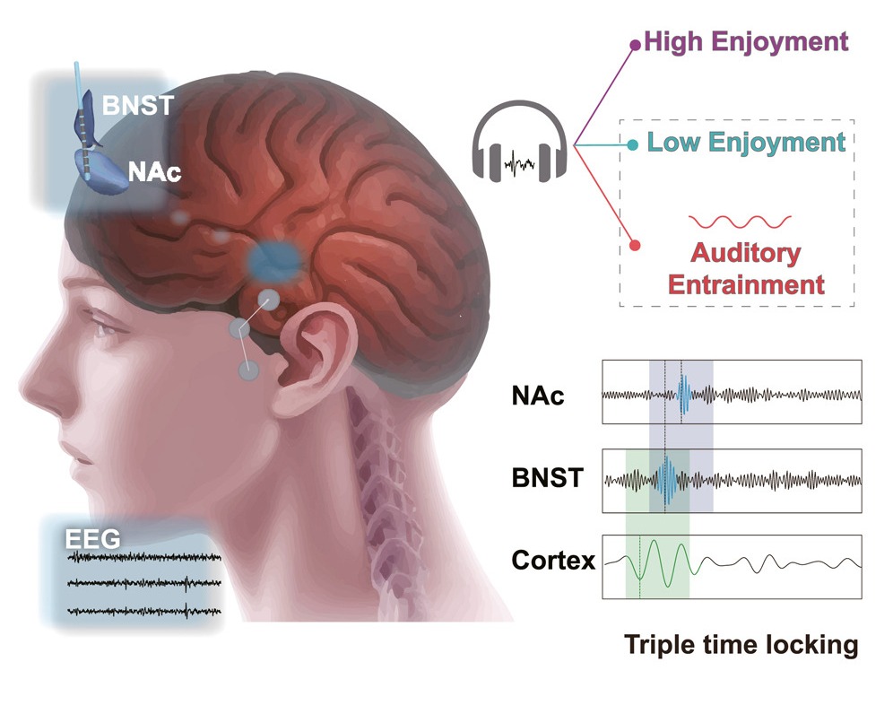 Cell Press (@cellpressnews) on Twitter photo Classical #music lifts our mood by synchronizing our “extended amygdala.”
Read more in <a href="/CellReports/">Cell Reports</a>:
cell.com/cell-reports/f…
<a href="/sjtu1896/">Shanghai Jiao Tong University</a> Valerie Voon, Bomin Sun Classical #music lifts our mood by synchronizing our “extended amygdala.”
Read more in <a href="/CellReports/">Cell Reports</a>:
cell.com/cell-reports/f…
<a href="/sjtu1896/">Shanghai Jiao Tong University</a> Valerie Voon, Bomin Sun