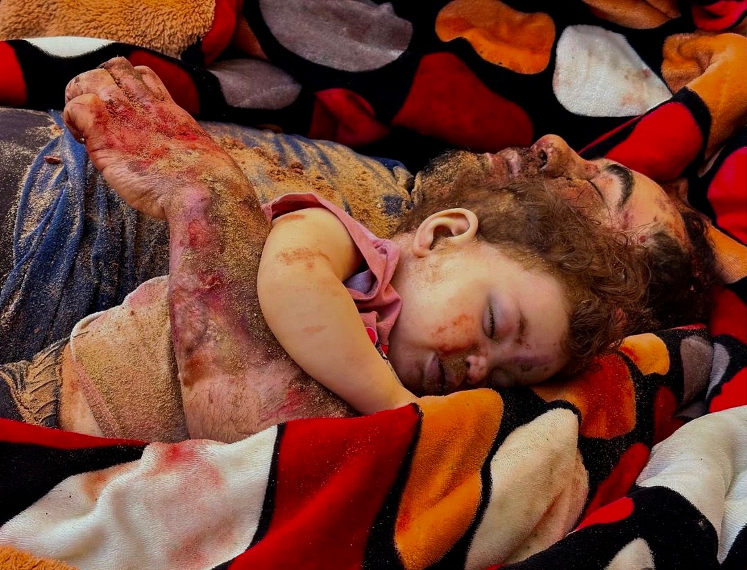 El Último Abrazo

#GazaGenocide 11.8.24 
Vía <a href="/dgkn_yl/">Dogukan</a>