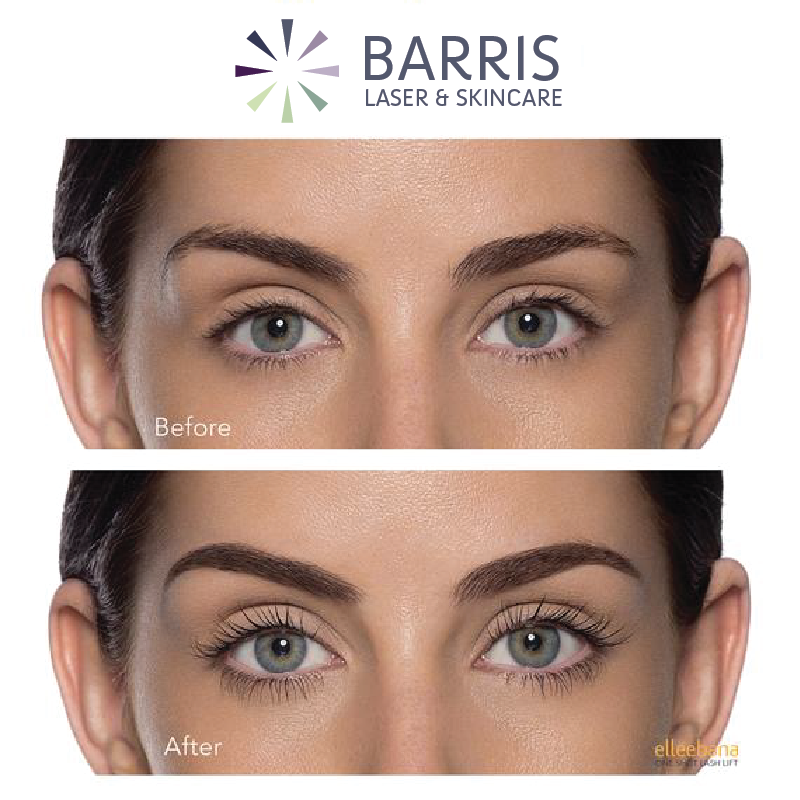 barrislaser's tweet image. ✨ Bright eyes and lifted lashes? Yes, please! Enjoy 20% off a pair of Image Skincare under-eye pads when you book a lash lift. Your eyes will thank you! 👁️✨

 #barrislaser // #BoulderMedSpa #BoulderSpa #BoulderLocal #LashLift #SkincareSavings #BrightEyes