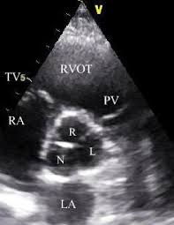 Ritika Tuli tweet media