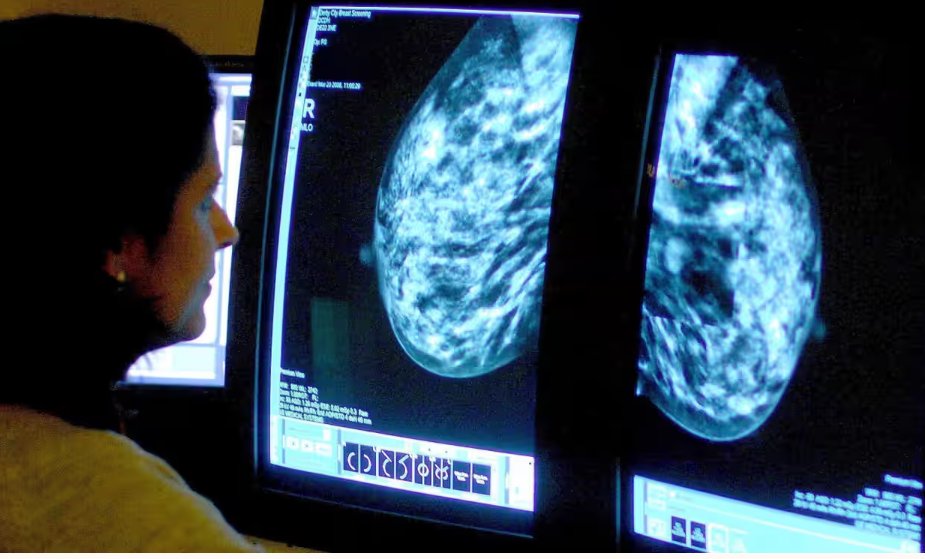 #BreastCancer’s tough choice: To remove, or not to remove, both breasts, by <a href="/vasilepi/">Vasily Giannakeas</a> <a href="/StevenNarod/">Steven Narod</a>  <a href="/DavidLimMD/">David W. Lim</a> theglobeandmail.com/opinion/articl… via <a href="/GlobeDebate/">Globe Opinion</a> @WCHresearch #BRCA1 #BRCA2