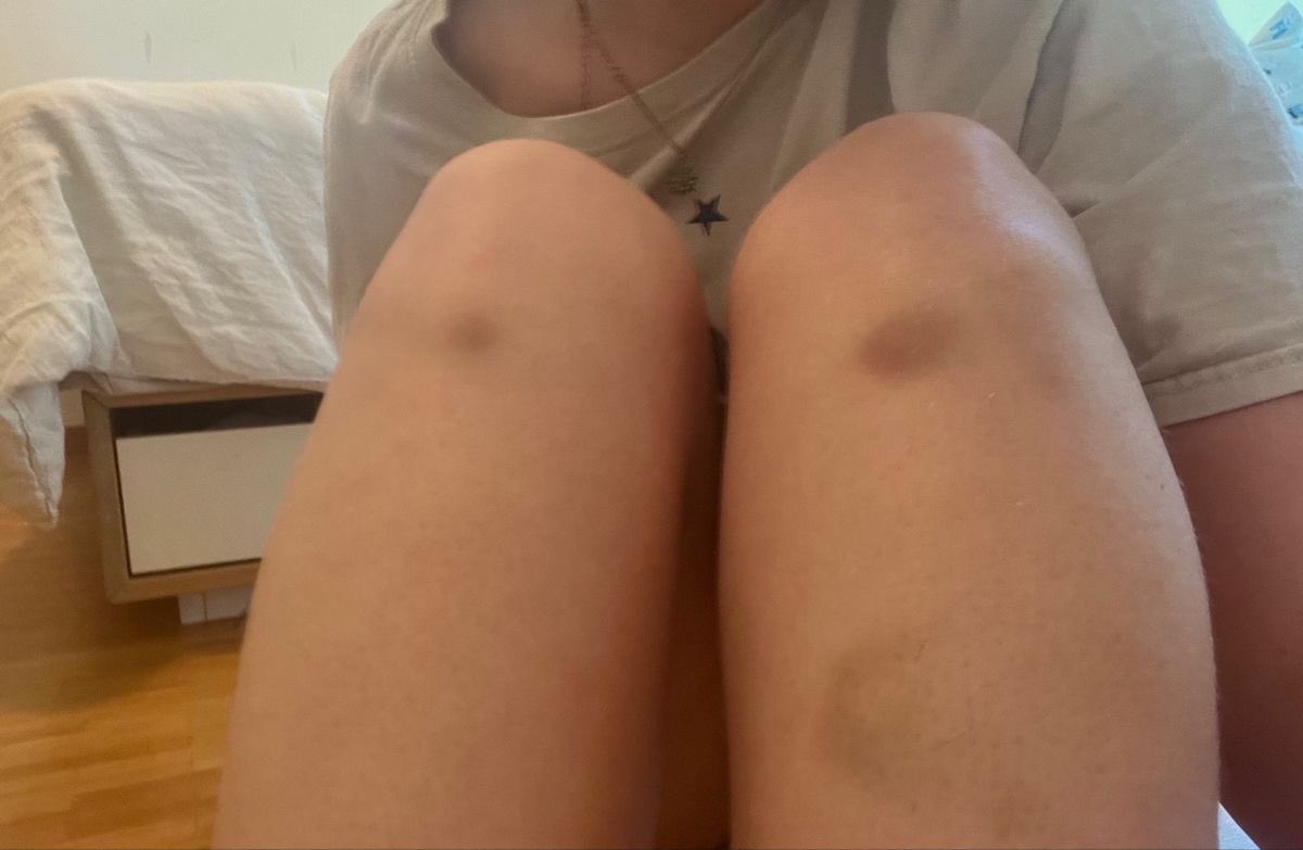 starryboness's tweet image. Why telling someone with a restrictive ED they “look healthy” isn’t the compliment you think it is 

an informative thread for edtwt 

likes, comments, and retweets appreciated!!