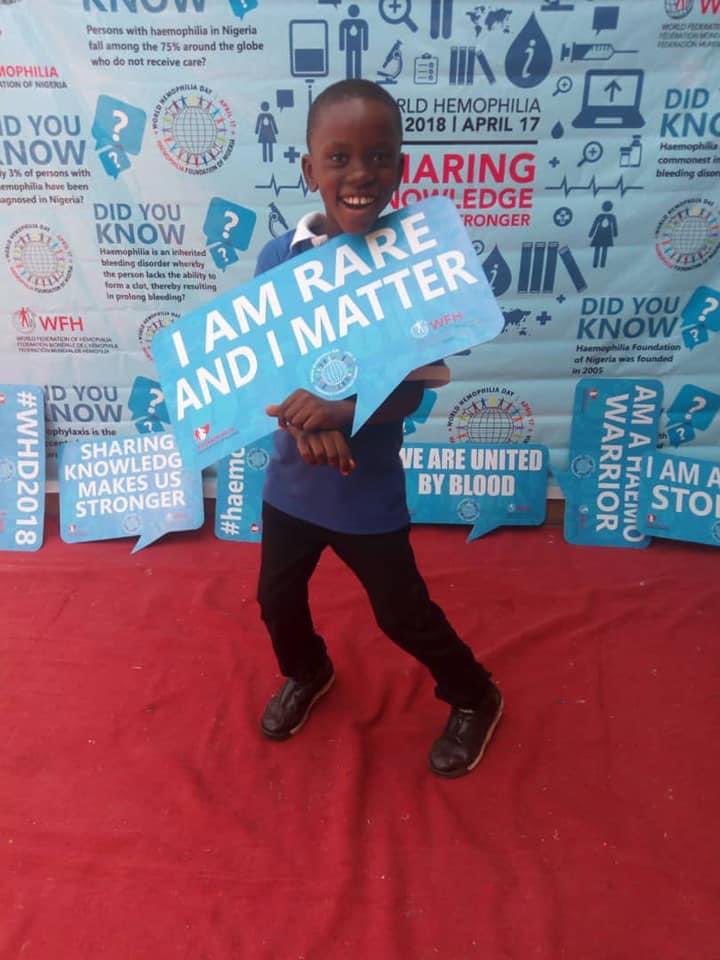 haemophilia_ng's tweet photo. 📢 Spread the word: Nigeria needs @NGRPresident @Fmohnigeria @NafdacAgency @NhisNg @nassnigeria involvement in procuring anti-hemophilia factor concentrates for persons living with Haemophilia #wearerarebutwematter https://t.co/PC1ER0Jyiv