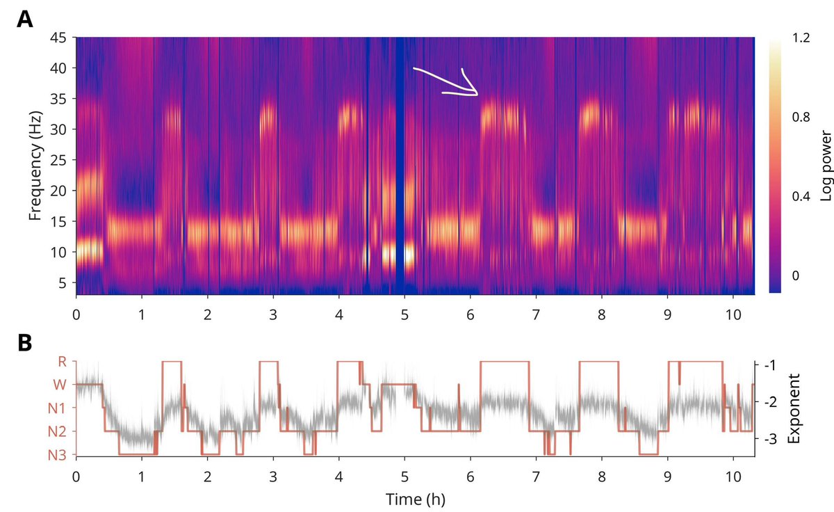 Sophia Snipes (@sophisnip) on Twitter photo What do you think? Are iota brain waves real? If you’re not convinced, tell me what more proof you need!
biorxiv.org/content/10.110… What do you think? Are iota brain waves real? If you’re not convinced, tell me what more proof you need!
biorxiv.org/content/10.110…