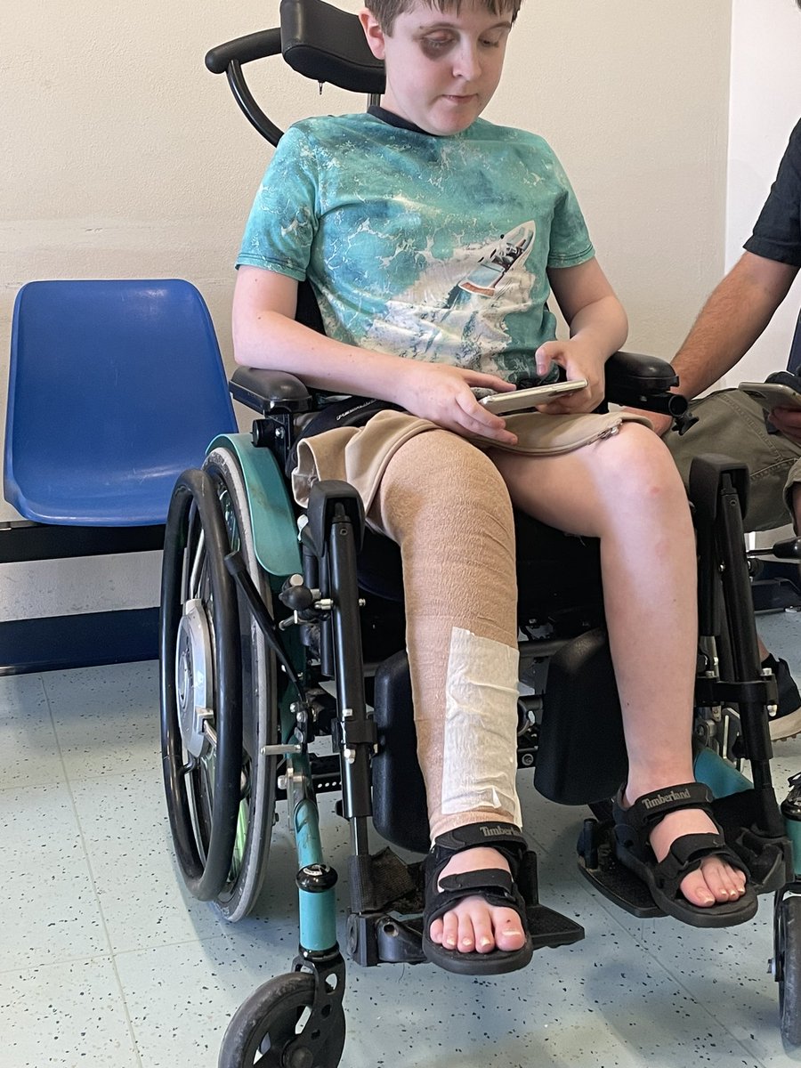 Wachtend op xray uitslag in hetzelfde ziekenhuis waar <a href="/hugodejonge/">Hugo de Jonge</a> een bezoekje bracht vorige week. Deze bambino werd even aangezien voor een voormalig minister🤣.