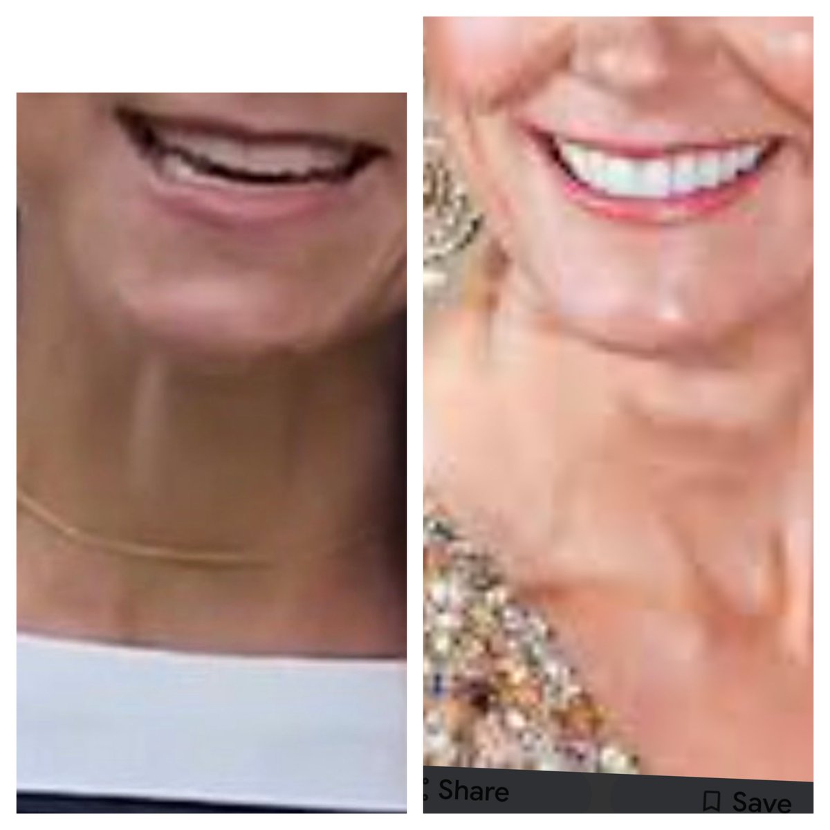 FionaSuccess's tweet photo. @JacquiDeevoy1 Different teeth 😳 https://t.co/LkXr9bc4hf