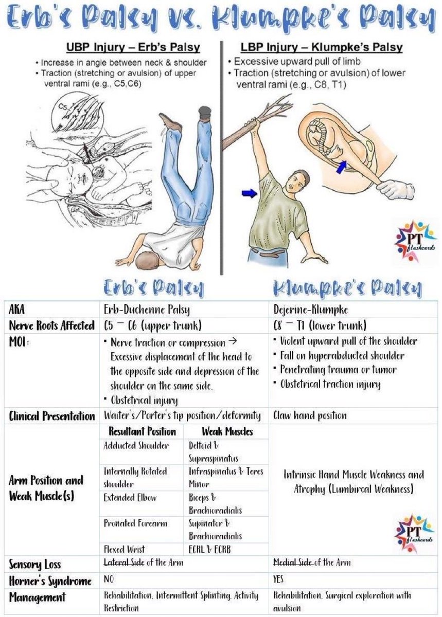 OGdukeneurosurg's tweet photo. Erb’s vs. Klempke’s Palsy https://t.co/9rYCr5mZEq