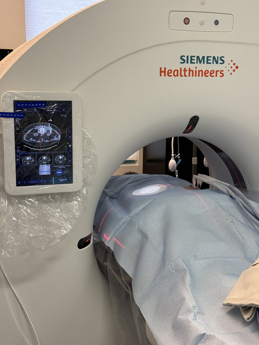 Curtis Anderson, MD, PhD, FSIR (@flendovasc) on Twitter photo Office-based, outpatient treatment of renal cell carcinoma under conscious sedation. Better for patient, operating physician and payors. Why would anyone want to routinely do these procedures in a hospital any more?<a href="/SiemensHealth/">Siemens Healthineers</a> <a href="/drmcumming/">Michael Cumming</a> <a href="/drcostantino1/">drcostantino</a> #irad Office-based, outpatient treatment of renal cell carcinoma under conscious sedation. Better for patient, operating physician and payors. Why would anyone want to routinely do these procedures in a hospital any more?<a href="/SiemensHealth/">Siemens Healthineers</a> <a href="/drmcumming/">Michael Cumming</a> <a href="/drcostantino1/">drcostantino</a> #irad