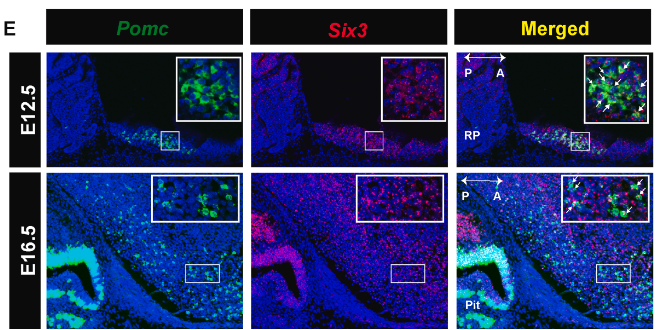 Dan Michele (@michelelabum) on Twitter photo New research from Hui Yu and the Low lab from <a href="/UMPhysiology/">UMPhysiology</a> in <a href="/MolMetab/">Molecular Metabolism</a> demonstrates the transcription factor Six3 regulates POMC neuron identity during development. Hui is now a faculty member starting her own lab at <a href="/osuansci/">Ohio State University Animal Sciences</a>. clinicalkey.com/#!/content/pla… New research from Hui Yu and the Low lab from <a href="/UMPhysiology/">UMPhysiology</a> in <a href="/MolMetab/">Molecular Metabolism</a> demonstrates the transcription factor Six3 regulates POMC neuron identity during development. Hui is now a faculty member starting her own lab at <a href="/osuansci/">Ohio State University Animal Sciences</a>. clinicalkey.com/#!/content/pla…
