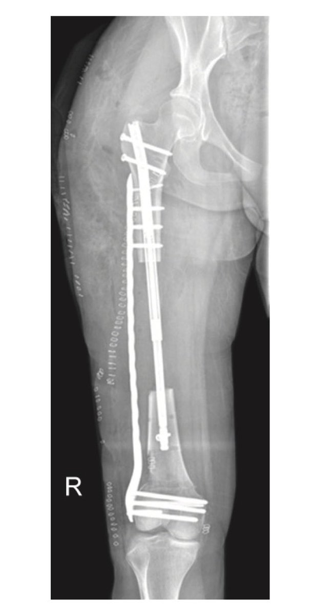 James A. Blair, MD, FAAOS, FACS tweet media