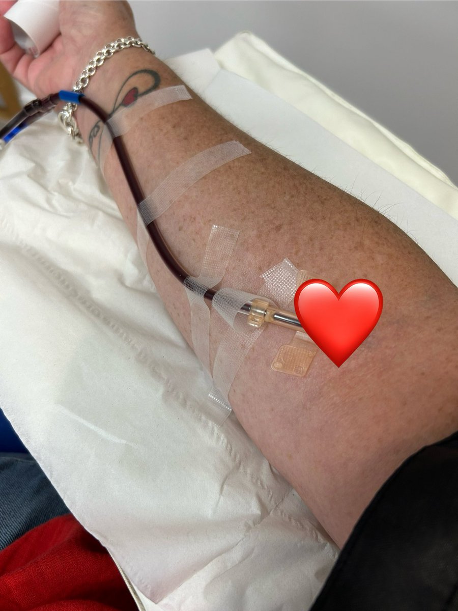 dgomm69's tweet photo. Platelet donation done today at Luton Donor Centre ❤️ Looking forward to receiving my text and finding out where my donation went to….. Save lives-give platelets
https://t.co/KQZr6bF7i0 @GiveBloodNHS @NHSBT #waitingfortext https://t.co/t5Ky5sWmhX