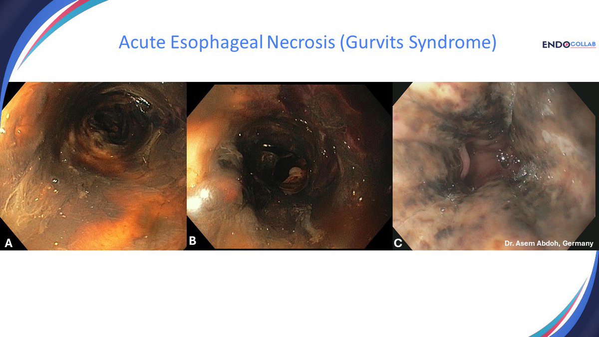 pexkewn's tweet photo. ✅ Gurvits syndrome 🔥 https://t.co/dV1IH7Etc4