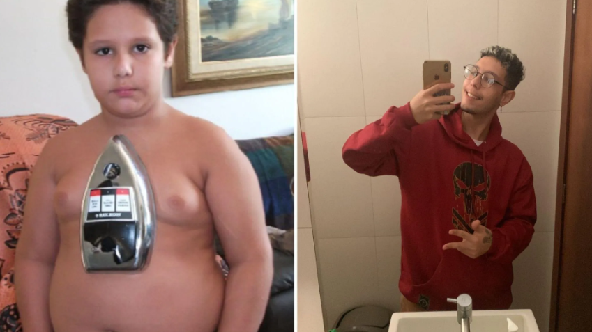 jornal_opopular's tweet photo. 'Menino ímã': Jovem que ficou famoso quando criança por grudar metais no corpo diz que perdeu 'poder'

📲 Leia Agora em O Popular: https://t.co/Zi88Jahisp
#LeiaAgora #OPopular #metais #Goiânia https://t.co/HM537caWjI