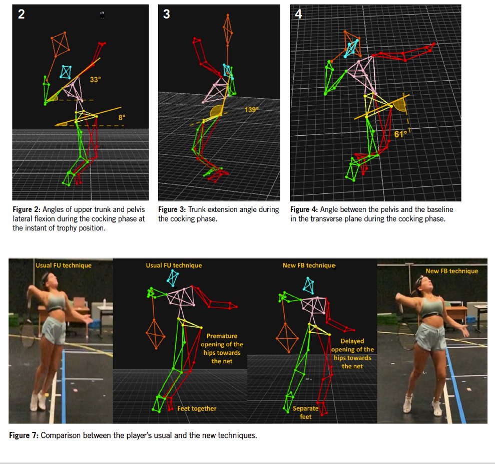 Utilize biomechanical analysis to reduce serve-related injuries.
Optimize performance and reduce risk with comprehensive evaluation.
Read More 👉 aspetar.com/biomechanical-…