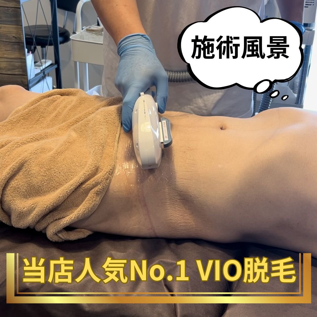 salonSHELBY's tweet photo. #男性VIO
#完全予約制
#男性施術者
#VIO女性受け
#清潔
#夏本番
#VIO痛くない
#VIO脱毛
#VIO脱毛おすすめ
#VIO脱毛のメリット
#vio専門
#脱毛有資格者
#金沢VIO脱毛
#個室サロン
#VIOメンズ脱毛専門店
#VIO脱毛ヨーロッパでは当たり前
#ツルツル
#脱毛モテる
#石川県金沢市 https://t.co/9tYZDUrfeW