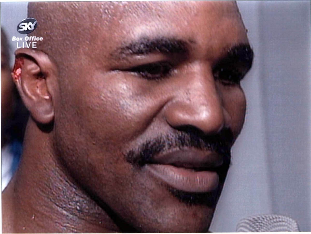 Your daily reminder that Holyfield never regrew his ear