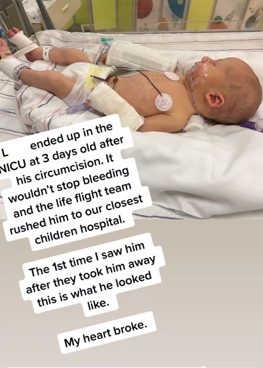 Severe bleeding from circumcision happens every day in the United States. Hospitals do not report such tragedies to any central health authority. The American Academy of Pediatrics therefore claims that the incidence of death and other complications from circumcision is unknown.