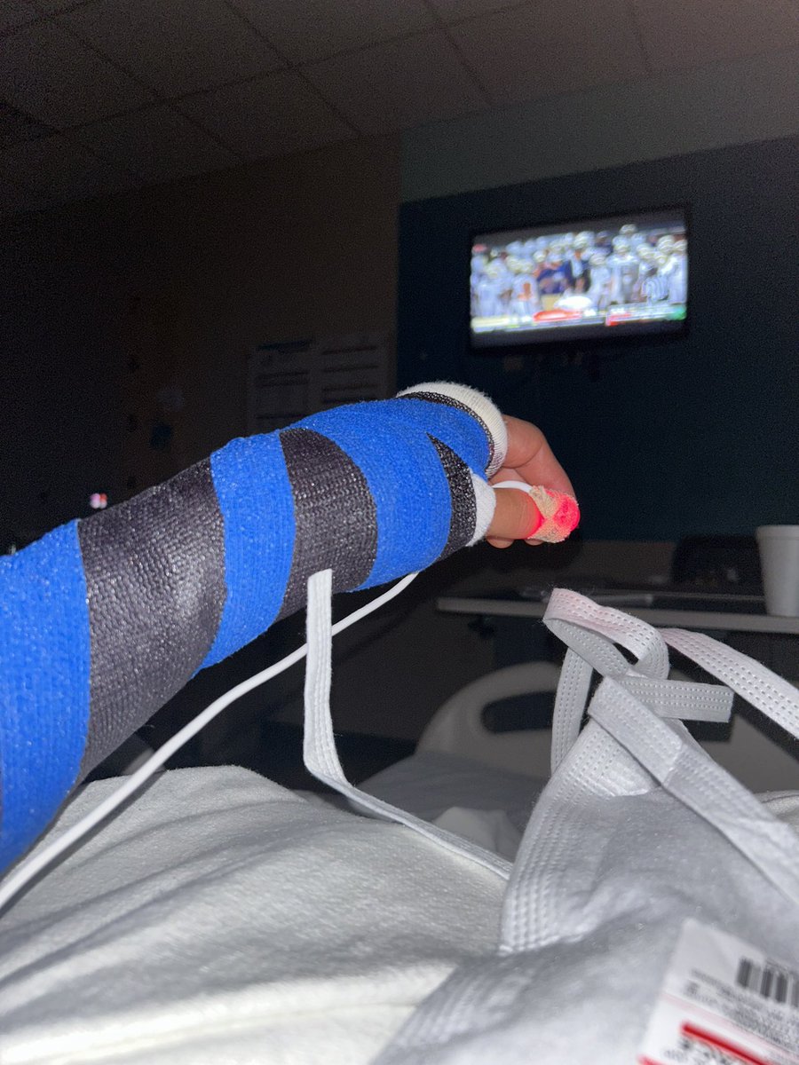 Unfortunately I will be out for 8 weeks due to a major injury on Friday night. Minor setback for a major comeback 🔜