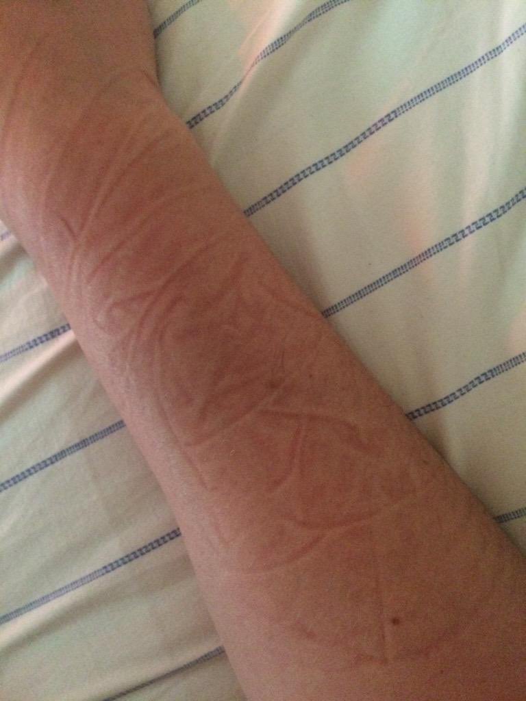 you KNOW the sleep was heavenly when you wake up with your arm like this