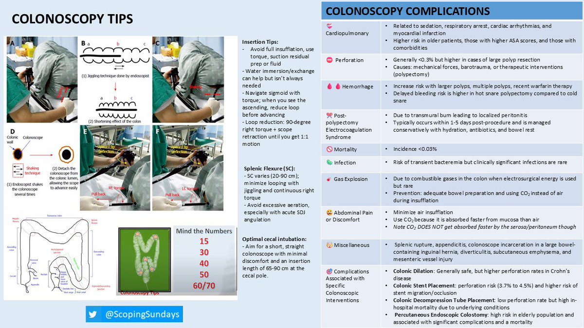 ScopingSundays's tweet photo. Missed out on the 🔥🔥 #ScopingSundays discussion last weekend on “Basics of #Colonoscopy”

Check out the #ScopingSummary from the interactive discussion led by @KiwanGIDoc, @s_taranika &amp; @fouadsjaber !

Special thanks to @KimberlyHoMD for the summary! https://t.co/MRBptLf9XY