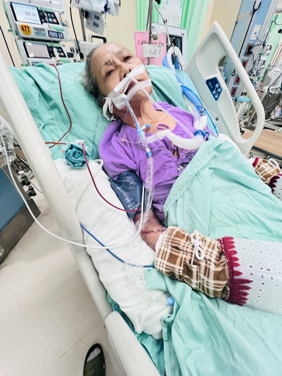 เล่าบ้าง แม่ผ่าตัด ลำไส้อุดตัด หมดไปเกือบ สองแสน เสียแค่ 200 กว่าบาท ค่ายานอกบัญชี สปสช. เงินไม่ใช่ตัวแปรเดียว แต่ระบบการรักษาการคัดกรองจากโรงบาลภาครัฐต่างหากละ นี่คือเคสฉุกเฉิน เขาก็ทำให้เร่งด่วน อย่าไปด่าภาครัฐ สะดวกใช้แบบไหนก็แบบนั้น