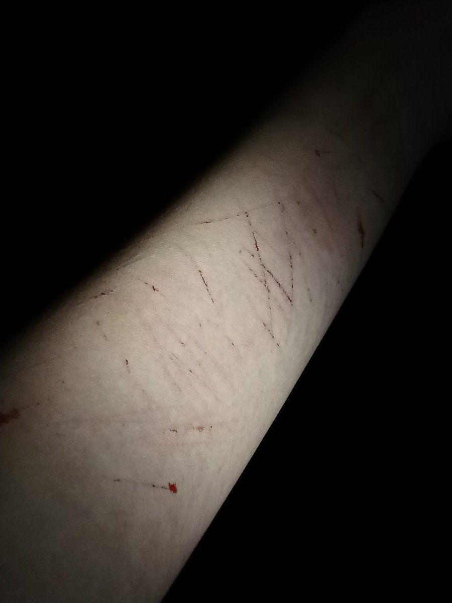 chamochipu's tweet photo. Last night since I was bored #selfharm #sh https://t.co/TGw2PUvqLz