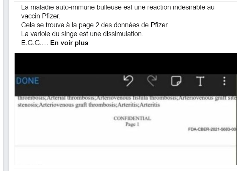 Les premiers cas de Mpox (connu par le passé comme variole de singe et monkeypox) sont apparus en 1958, très longtemps avant les vaccins anti-covid... Article de Congo Check 🇨🇩 qui remet les pendules à l'heure.
paff.africa/non-la-mpox-ne…