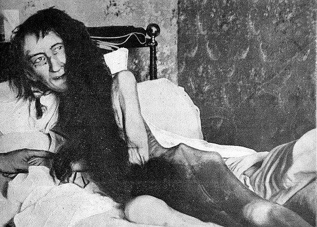 TopStoryContent tweet media