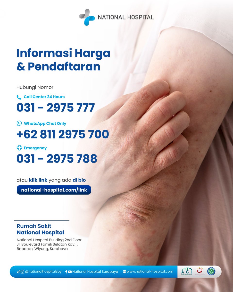 Hati-Hati Cacar Monyet, Kenali Gejalanya!
Kenali gejalanya sekarang dan cegah dengan ketahui cara penularannya. Stop cacar monyet!
#NationalHospital