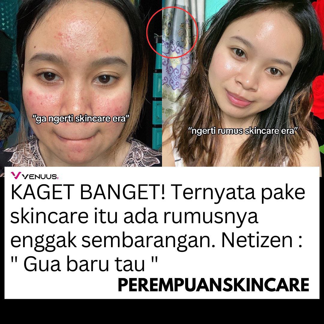 Ternyata skincare ada rumusnya juga