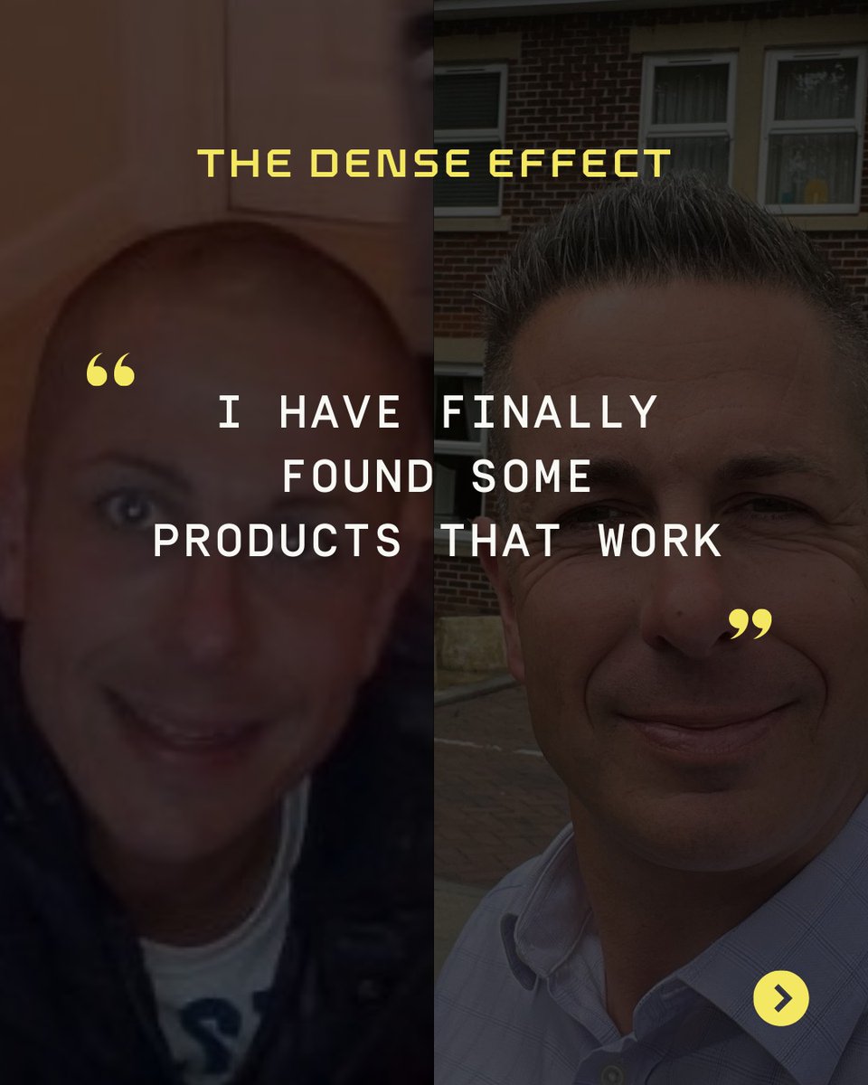 Dense Hair Experts tweet media