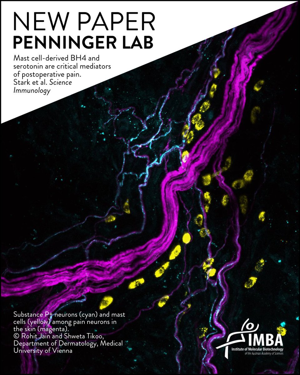 IMBA imbavienna.bsky.social (@imba_vienna) on Twitter photo New research from <a href="/cronin_sjf/">Shane JF Cronin</a> and Josef Penninger at the <a href="/penningerlab/">PenningerLab</a> and <a href="/PhilippStarkl/">Philipp Starkl</a> at <a href="/MedUni_Wien/">MedUni Wien</a> shows that reducing production of the neuropathic pain mediator molecule BH4 could effectively treat chronic postoperative pain. More info: bit.ly/3T0238D New research from <a href="/cronin_sjf/">Shane JF Cronin</a> and Josef Penninger at the <a href="/penningerlab/">PenningerLab</a> and <a href="/PhilippStarkl/">Philipp Starkl</a> at <a href="/MedUni_Wien/">MedUni Wien</a> shows that reducing production of the neuropathic pain mediator molecule BH4 could effectively treat chronic postoperative pain. More info: bit.ly/3T0238D
