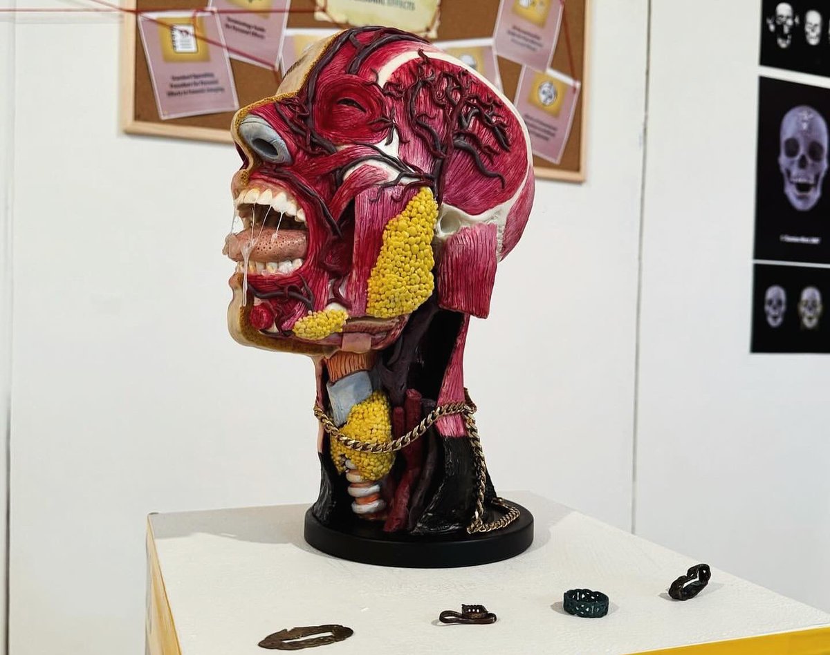 MariaMMaclennan's tweet image. TYSM to everyone who came to the Opening Night @DJCAD #DJCADMastersShow! 💀🎨

Here’s a preview of the work I’m currently showing in ‘Forensic Art(efacts)’, running until Sunday 1st September 2024. Pop along &amp;amp; see the work of my colleagues &amp;amp; peers in #ForensicArt &amp;amp; #MedicalArt!