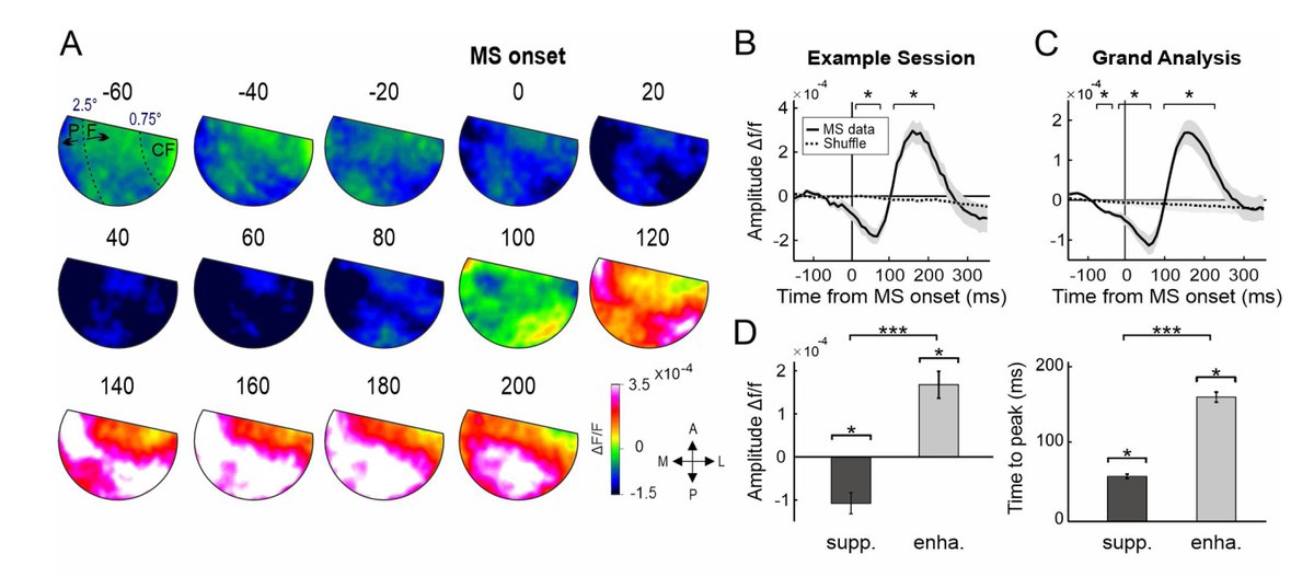 Gonda Brain Research Center (@gondabrain) on Twitter photo A new preprint by Yarden Nativ and co-author Tomer Bouhnik from the lab of Prof. Hamutal Slovin:
"The effect of microsaccades in the primary visual cortex: a two-phase modulation in the absence of visual stimulation". biorxiv.org/content/10.110…
<a href="/Bar_ilan/">אוניברסיטת בר-אילן</a> <a href="/HamutalSlovin/">Hamutal Slovin</a> A new preprint by Yarden Nativ and co-author Tomer Bouhnik from the lab of Prof. Hamutal Slovin:
"The effect of microsaccades in the primary visual cortex: a two-phase modulation in the absence of visual stimulation". biorxiv.org/content/10.110…
<a href="/Bar_ilan/">אוניברסיטת בר-אילן</a> <a href="/HamutalSlovin/">Hamutal Slovin</a>