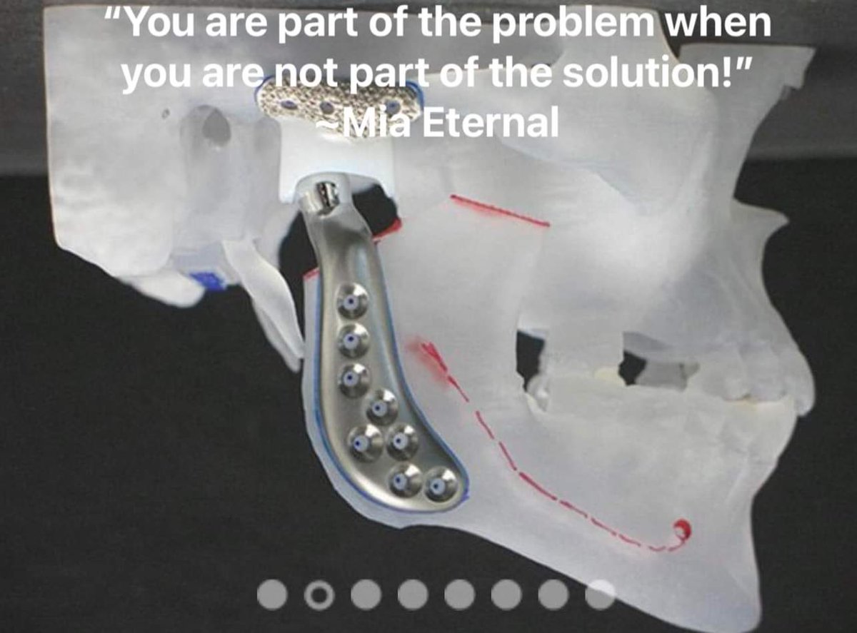 MiAmorEternal's tweet photo. This is my solution to TMJ problems that are hereditary and inevitable. My surgery is available and I’m not waiting when it can be done today! No more EXCUSES that insurance can’t cover this because it is medical necessity as I am on a feeding tube! https://t.co/2Yd3Se54dv