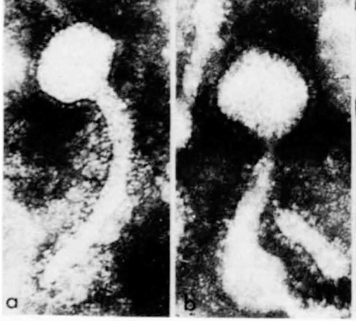IAC_journal's tweet photo. Just published! The viral origins of breast cancer https://t.co/AWPxN6NjPI https://t.co/hnE3Ihnlfw
