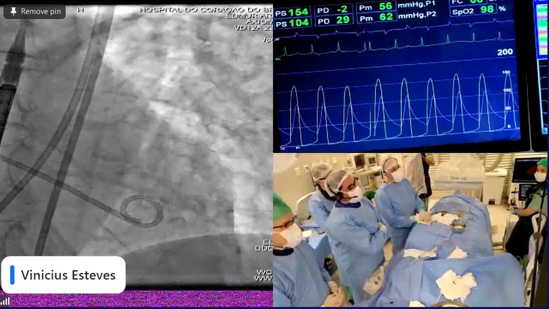 Vinicius Esteves,MD PhD FESC (@vinesteves) on Twitter photo Nice transmission last Friday to 🇺🇸 using the excellent MEDINBOX AIR portable system !! Great case with a lot of discussion on small annulus anatomies. <a href="/GuiAttizzaniMD/">Gui Attizzani</a> <a href="/Almanfi_Cardio/">Abdelkader Almanfi, MD, FACC, FSCAI</a> <a href="/medinbox/">Medinbox</a> <a href="/modine_thomas/">thomas modine</a> <a href="/didier_tchetche/">Didier Tchetche</a> <a href="/msztejfman/">Matias Sztejfman</a> <a href="/JGMD63/">Juan Gaspar</a> <a href="/NicoGausserand/">Nicolas Gausserand</a> Nice transmission last Friday to 🇺🇸 using the excellent MEDINBOX AIR portable system !! Great case with a lot of discussion on small annulus anatomies. <a href="/GuiAttizzaniMD/">Gui Attizzani</a> <a href="/Almanfi_Cardio/">Abdelkader Almanfi, MD, FACC, FSCAI</a> <a href="/medinbox/">Medinbox</a> <a href="/modine_thomas/">thomas modine</a> <a href="/didier_tchetche/">Didier Tchetche</a> <a href="/msztejfman/">Matias Sztejfman</a> <a href="/JGMD63/">Juan Gaspar</a> <a href="/NicoGausserand/">Nicolas Gausserand</a>