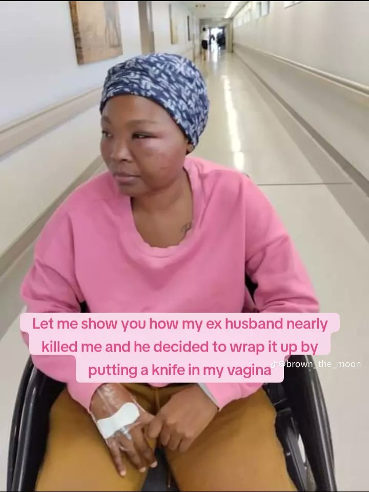 MissSteelo's tweet photo. How is this not getting the attention it requires. Should this woman die first before something is done? @_Hybreed_ @destinyzee @Miz_Ruraltarain  sizani hle😭😭😭😭😭😭 https://t.co/Dba5eKqIRZ