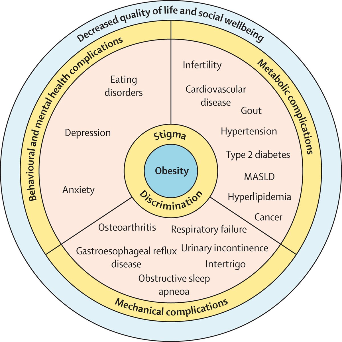 Obesity is a growing global epidemic with major health consequences.

Bariatric surgery is the most effective treatment, with progress in the development of pharmacological agents. However, all obesity treatments have been underutilised.

Find out more: 
hubs.li/Q02M2xq50